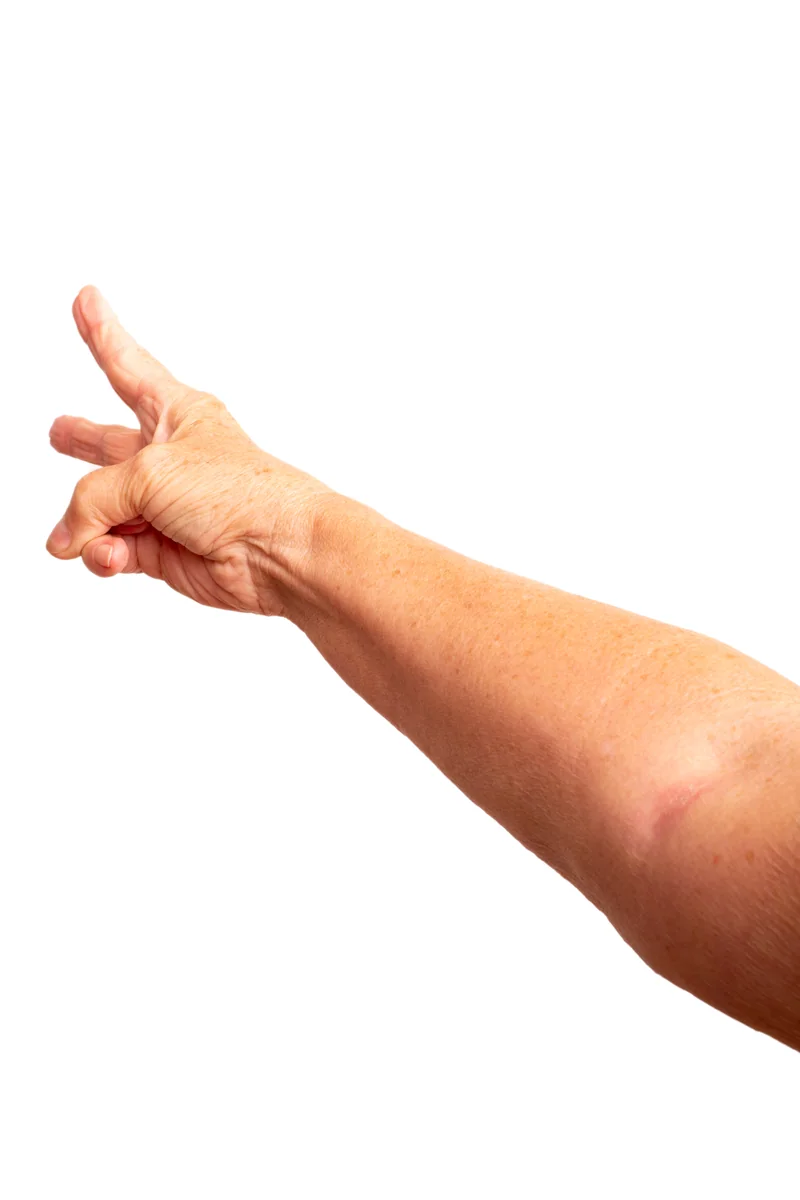 Scissors hand gesture